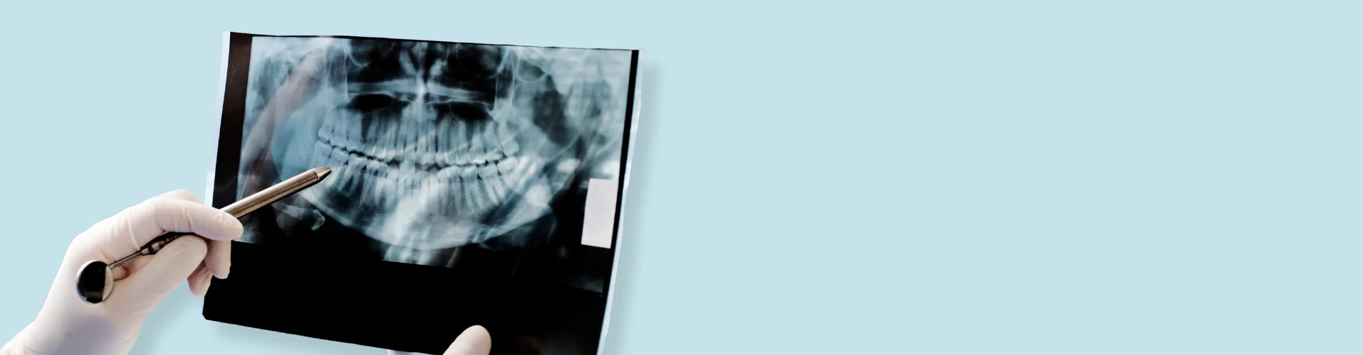Dental X-ray in Navi Mumbai