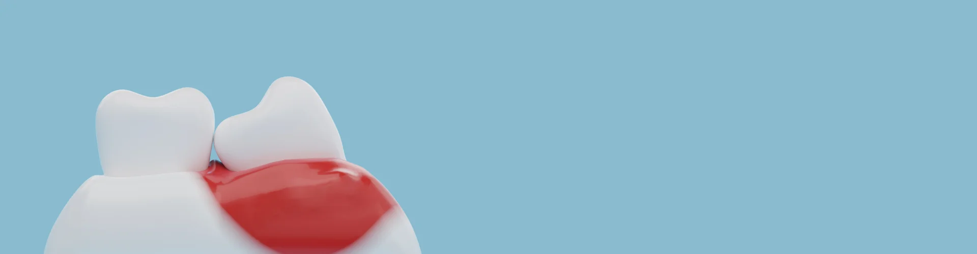 Flap Surgery & Gum Treatments in Navi Mumbai