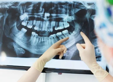 advanced digital dental x rays in navi mumbai dr siddhesh karanjekar