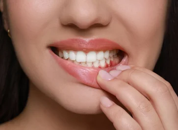 best gum problems treatment airoli navi mumbai